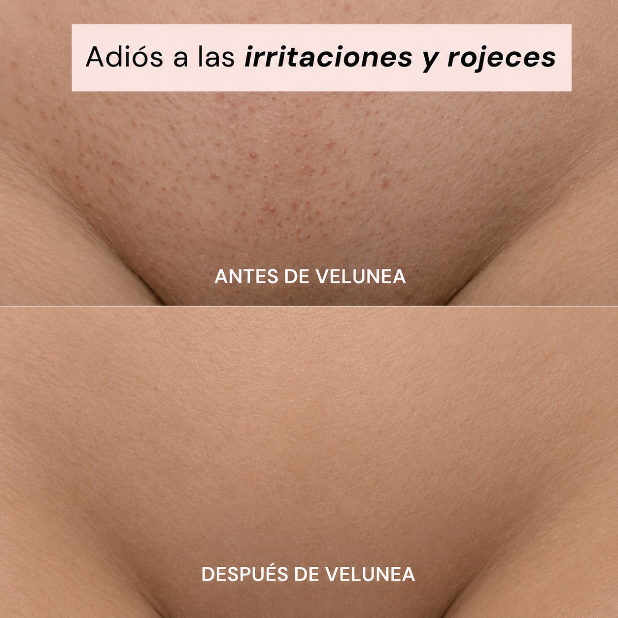 VELUNEA™ — El ritual de depilación que mereces