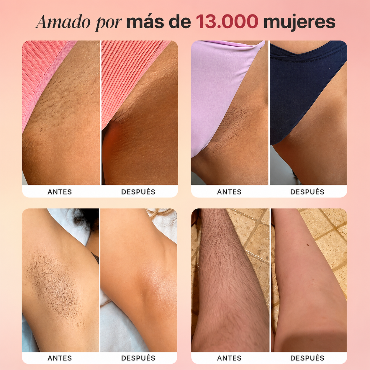 VELUNEA™- depilación de clínica desde casa